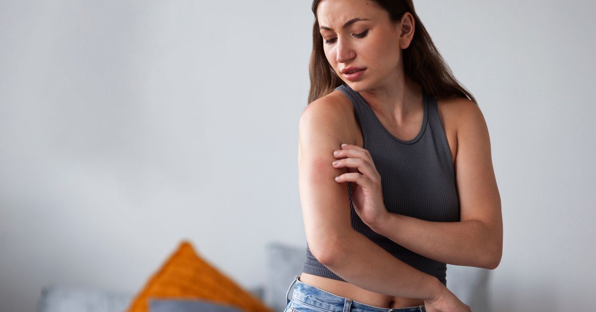 Cos'è la dermatite psicosomatica