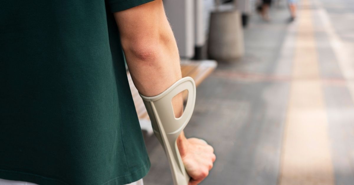 Cosa sono le lesioni personali
