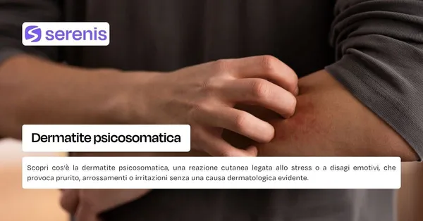 Dermatite psicosomatica